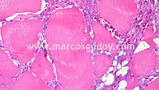 necrotizing-myositis-by-piscirickettsia-salmonis-iii necrotizing-myositis-by-piscirickettsia-salmonis-iii