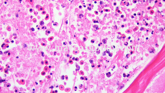 necrotizing-myositis-by-piscirickettsia-salmonis-iv necrotizing-myositis-by-piscirickettsia-salmonis-iv