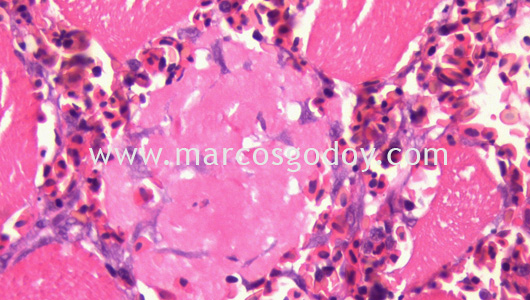 necrotizing-myositis-by-piscirickettsia-salmonis-v necrotizing-myositis-by-piscirickettsia-salmonis-v
