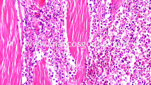 necrotizing-myositis-by-piscirickettsia-salmonis-vii necrotizing-myositis-by-piscirickettsia-salmonis-vii