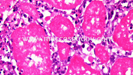 necrotizing-myositis-by-piscirickettsia-salmonis-viii necrotizing-myositis-by-piscirickettsia-salmonis-viii