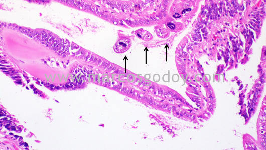 mantoscyphidia-concholepas-i
