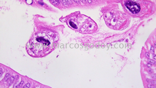 mantoscyphidia-concholepas-ii