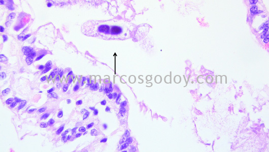 mantoscyphidia-concholepas-iii1