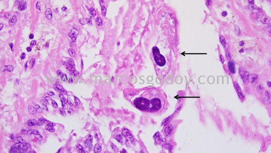 mantoscyphidia-concholepas-iv