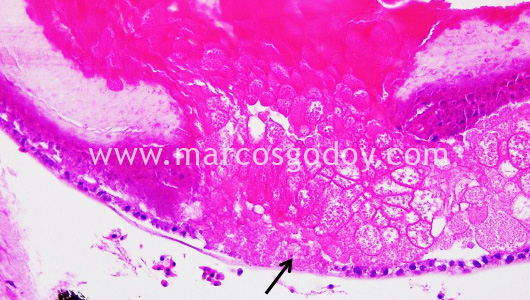 atlantic-halibut-larvae-cataract-ii