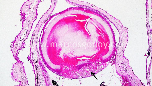 atlantic-halibut-larvae-cataract-iii