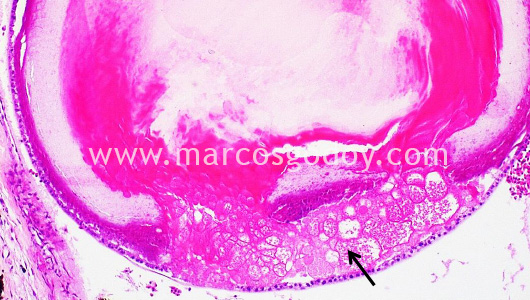 atlantic-halibut-larvae-cataract-iv