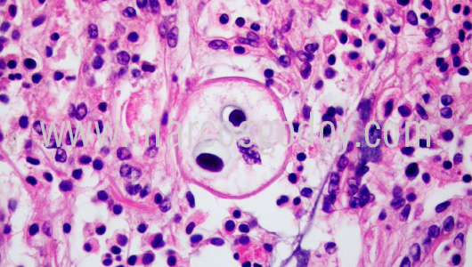 apicomplexa-prothotaca-thaca-i