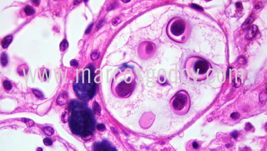 apicomplexa-prothotaca-thaca-ii