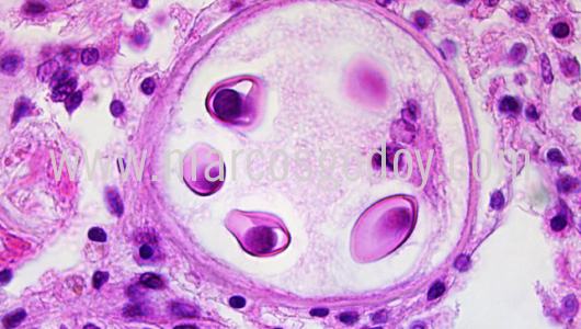apicomplexa-prothotaca-thaca-iii1