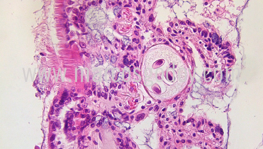 apicomplexa-prothotaca-thaca-iv