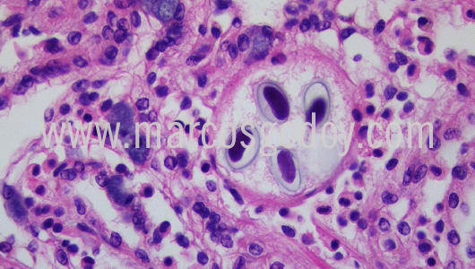 apicomplexa-prothotaca-thaca-v