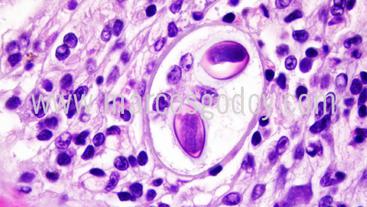 apicomplexa-prothotaca-thaca-vi1