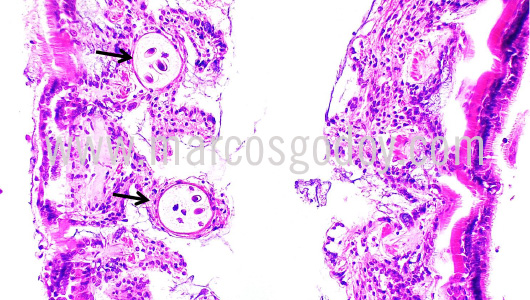 apicomplexa-prothotaca-thaca-vii1