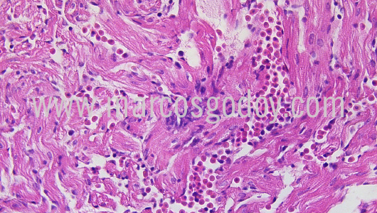 histopathology-chancharro-helicolenus-lengerichi-ii