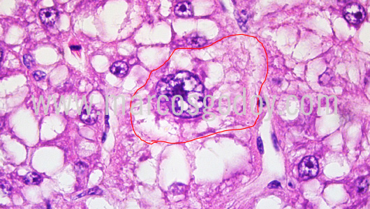 histopathology-chancharro-helicolenus-lengerichi-iii