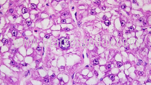 histopathology-chancharro-helicolenus-lengerichi-iv