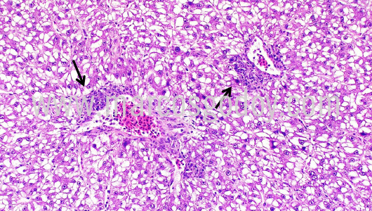 histopathology-chancharro-helicolenus-lengerichi-v