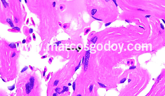 cardiac-fibers-nuclear-alterations-i cardiac-fibers-nuclear-alterations-i