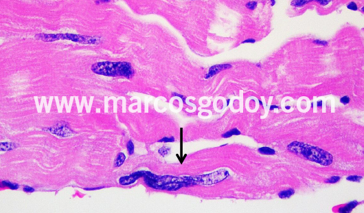 cardiac-fibers-nuclear-alterations-ii cardiac-fibers-nuclear-alterations-ii