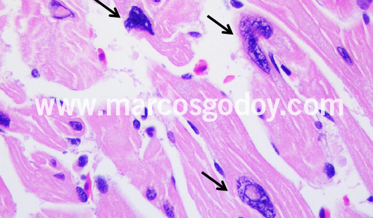 cardiac-fibers-nuclear-alterations-iii cardiac-fibers-nuclear-alterations-iii