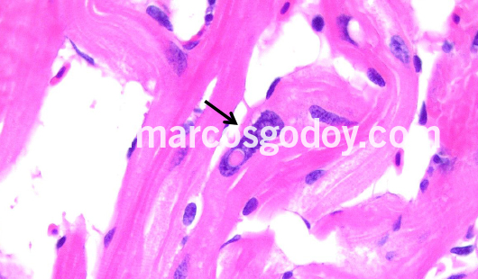 cardiac-fibers-nuclear-alterations-iv cardiac-fibers-nuclear-alterations-iv