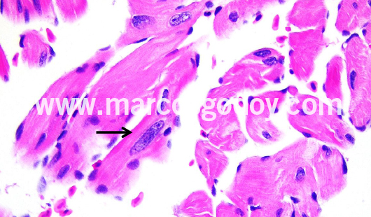 cardiac-fibers-nuclear-alterations-ix cardiac-fibers-nuclear-alterations-ix