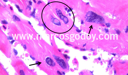 cardiac-fibers-nuclear-alterations-v cardiac-fibers-nuclear-alterations-v