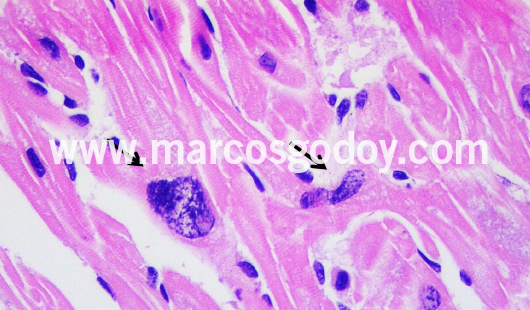 cardiac-fibers-nuclear-alterations-vi cardiac-fibers-nuclear-alterations-vi