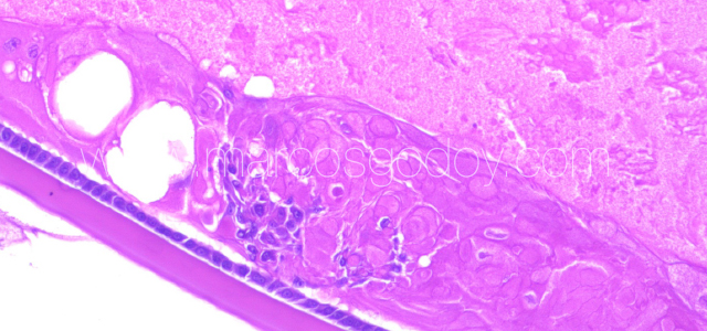 Atlantic salmon cataract histopathology I