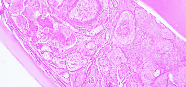 Atlantic salmon cataract histopathology II