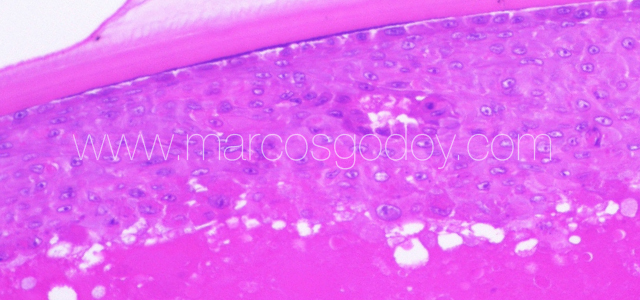 Atlantic salmon cataract histopathology III