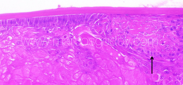 Atlantic salmon cataract histopathology IV