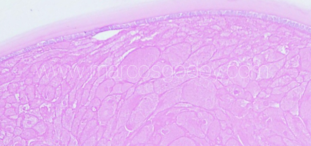 Atlantic salmon cataract histopathology VI