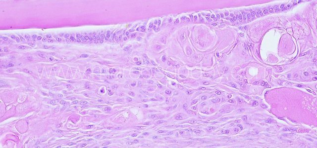 Atlantic salmon cataract histopathology VII