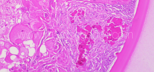 Atlantic salmon cataract histopathology XV