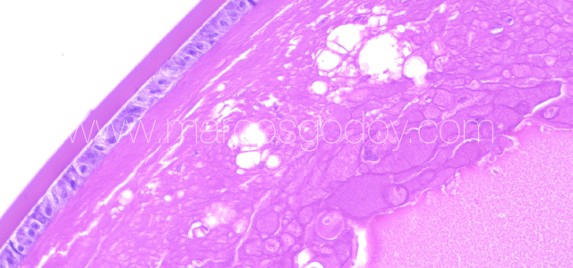 Atlantic salmon cataract histopathology XVI