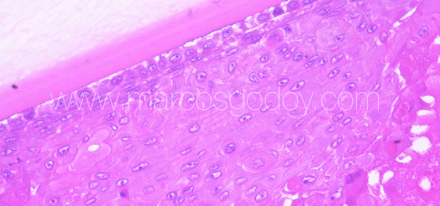 Atlantic salmon cataract histopathology XVIII