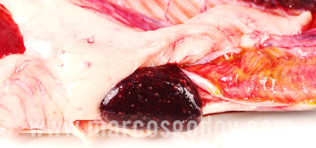 Bacterial kidney diseases - Gross pathology I