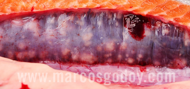 Bacterial kidney diseases - Gross pathology IV
