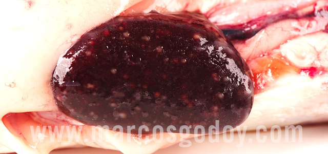 Bacterial kidney diseases - Gross pathology XVI