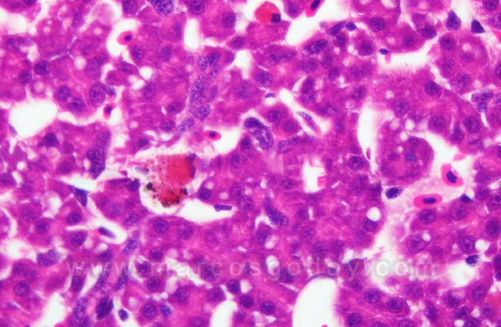 Centros de Melanomacrófagos en hígado de Salmón del Atlántico (Salmo salar) rezagados: Histopatología