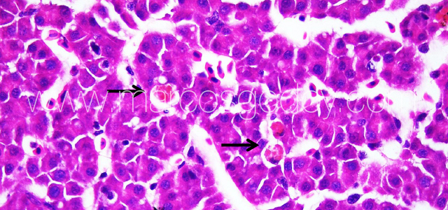 Liver melanomacrophahes center IV