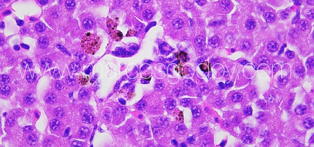 Liver melanomacrophahes center IX