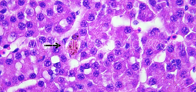 Liver melanomacrophahes center V