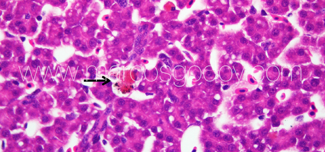 Liver melanomacrophahes center X