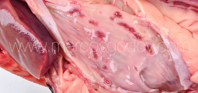 Erosive gastritis II