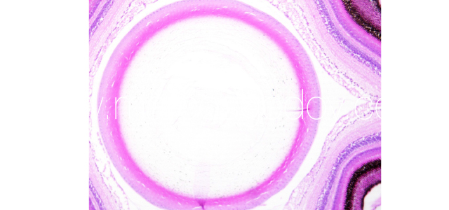 Lens deformation I