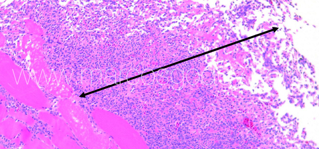 Exophiala muscle III